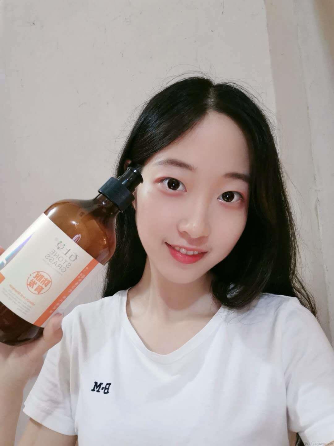 冬天掉头发很厉害怎么办