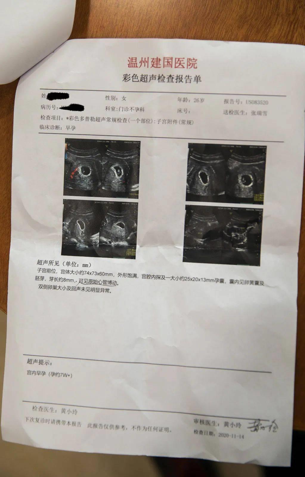 如何检查内分泌失调