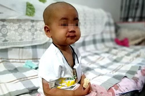 高烧不退又发冷怎么办