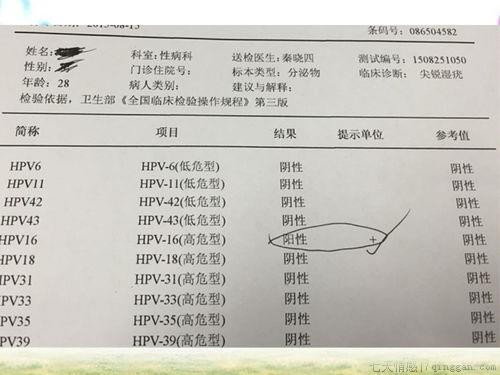 hpv检查结果怎么看