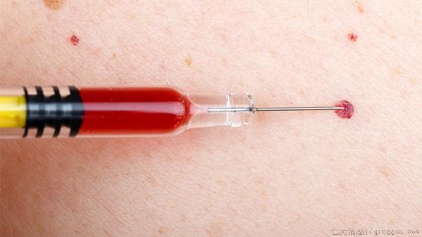 hiv阴性是什么意思