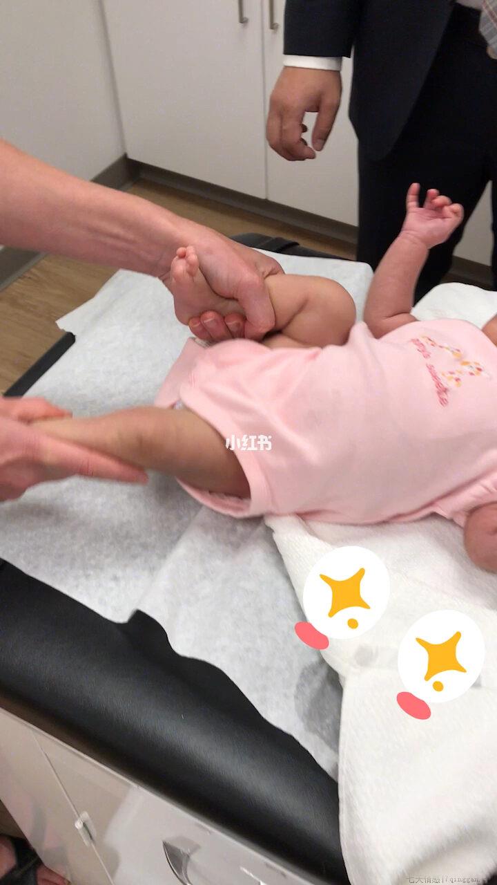 婴儿胀气怎么办快速排气
