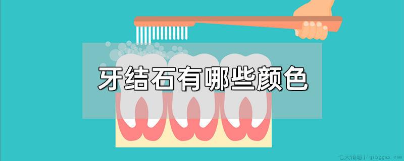 牙结石有哪些颜色