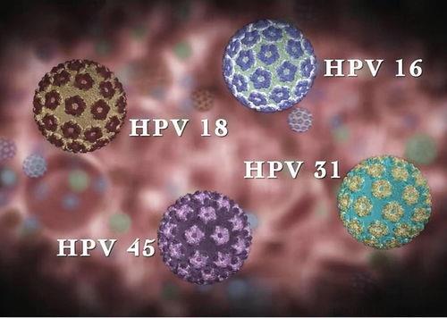 hpv病毒传染吗