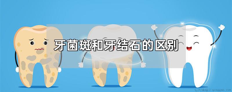 牙菌斑和牙结石的区别