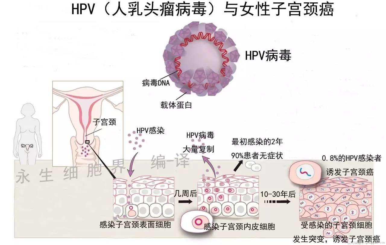 hpv是什么引起的