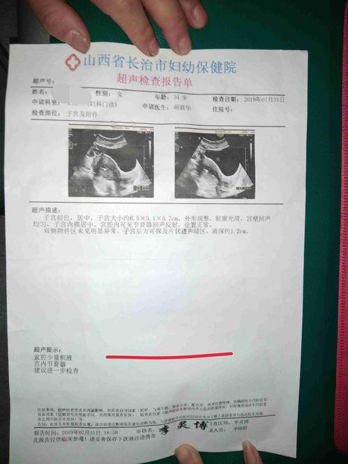 月经推迟小腹胀痛的原因