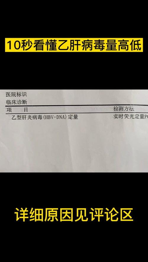 hbv-dna正常值是多少