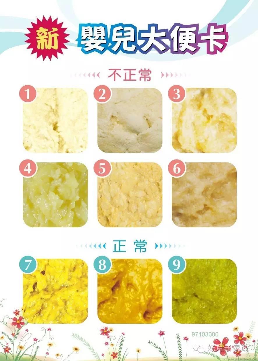 新生儿不拉大便怎么办
