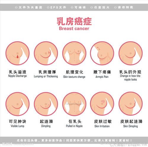 乳腺癌的症状有哪些