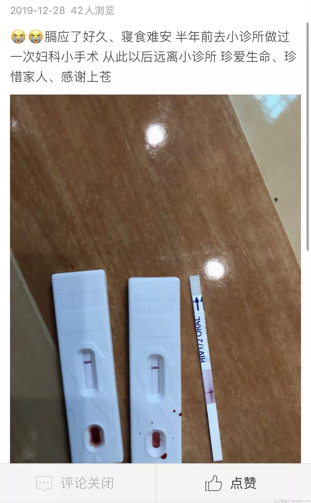 hiv试纸怎么用