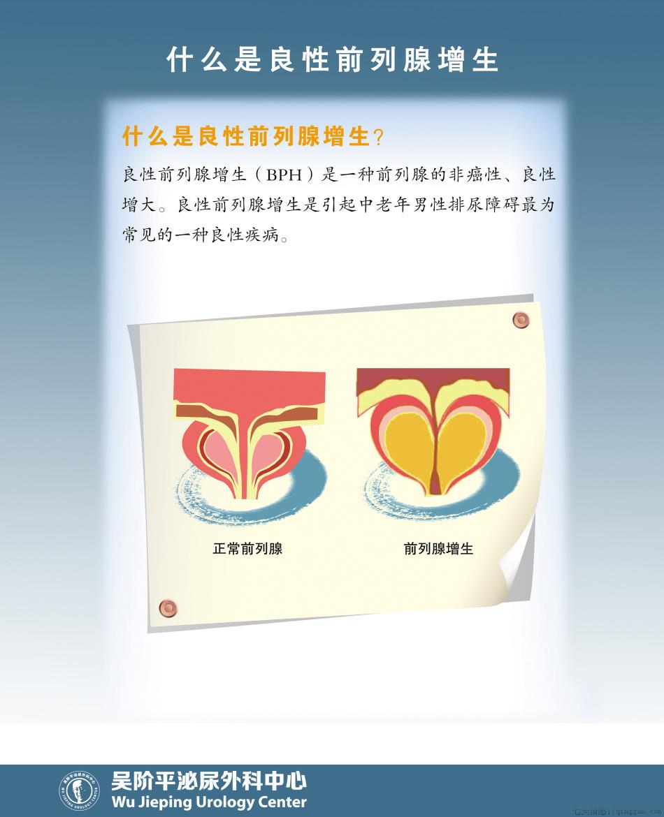 什么是良性前列腺增生