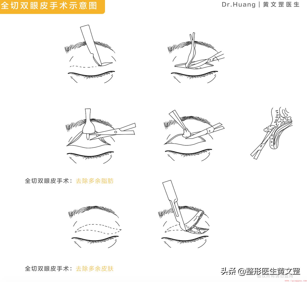 三角眼是什么眼型图片