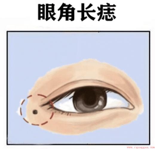 代表什么意思