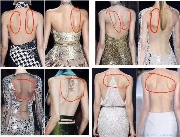 蝴蝶背是什么意思