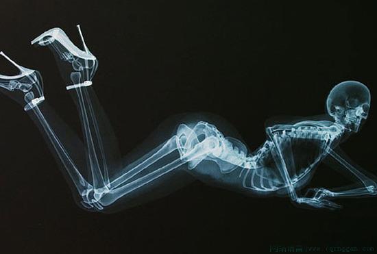 骨感是什么意思