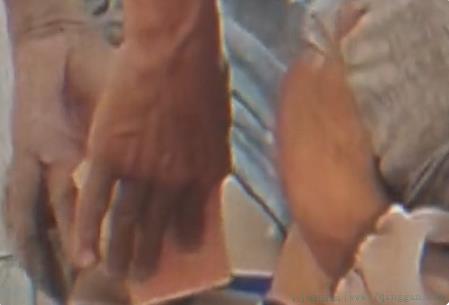 万通镜骨贴是什么意思