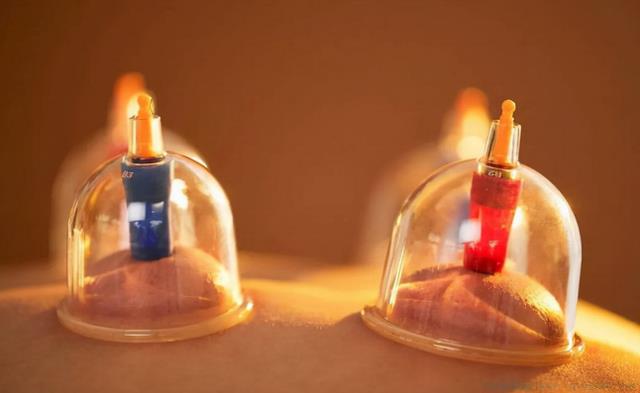 拔火罐是什么意思