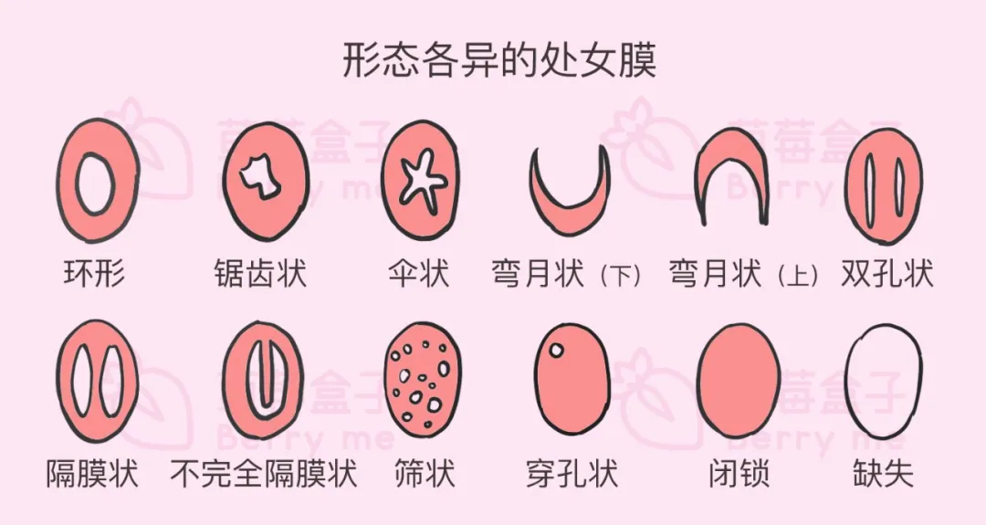 女生第一次都会很疼吗 - 第2张