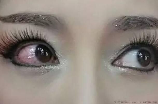 带了十年隐形眼镜后果