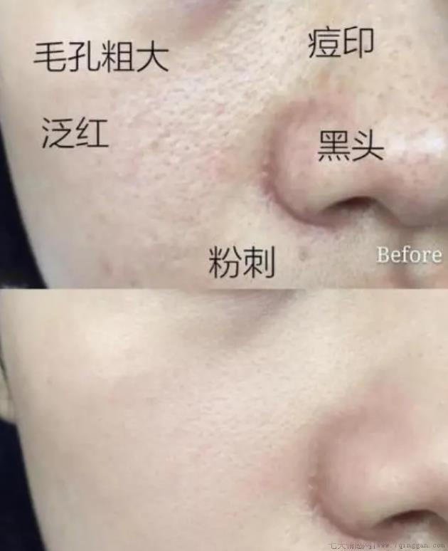 上海硫磺皂可以洗脸吗