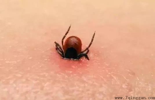 被蜱虫咬了死亡率高吗？被蜱虫咬了一定会得病么？