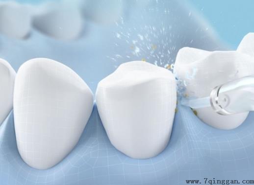 冲牙器的水装一次能用多久？冲牙器的使用寿命是多长？