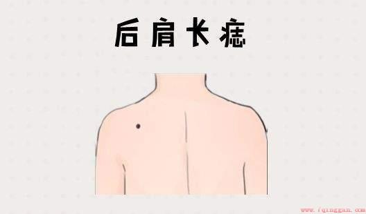 男人肩膀上有痣代表什么含义